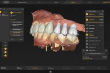 Digital Denture Workflows