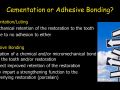 Adhesive Cementation - Part 1 General Concepts