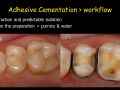 Adhesive Cementation - Part 5 Adhesive Clinical Process