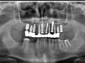 Surgical and Clinical Implant Dentistry - Introduction