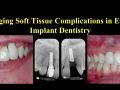 Managing soft tissue complications in esthetic implant dentistry – Part 1