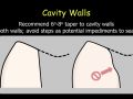 CEREC Preparations - Onlays - Cavity Walls
