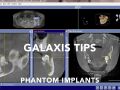 Galaxis - Tips - Phantom Implants