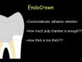 CEREC EndoCrowns - Pulp Chamber Preparation
