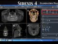 Academy Online Continuum - SIDEXIS 4 software review Part 2