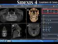 Academy Online Continuum - SIDEXIS 4 software review Part 3