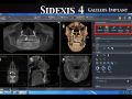 Academy Online Continuum - SIDEXIS 4 software review Part 4 and Galaxis