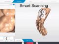 5. CEREC Primescan Smart Scanning