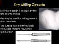 20. Chairside Zirconia - Dry Mill Zirconia Margins