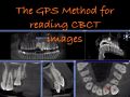 Introduction To The GPS Method Of Reading CBCT Images