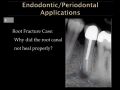 Applications for CBCT - Endodontic And Periodontal Findings