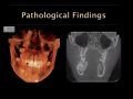 Applications for CBCT - Pathological Findings