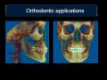 Applications for CBCT - Orthodontics
