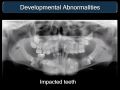 Applications for CBCT - Developmental Abnormalities