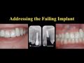 Addressing the Failing Implant