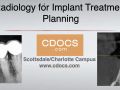 Radiology for Implant Treatment Planning