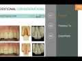 Endodontic Case Selection - Part 4 Additional Considerations
