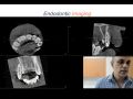 Endodontic Case 3 - Part 2 - Cone Beam View