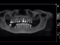 Easy Way to Show Someone a Finding on CBCT Volume