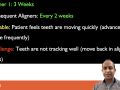 Tip of the Day - Aligner Frequency
