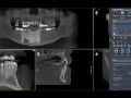 Tip of the Day - Make PA from CBCT