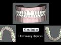 Ortho Relapse Case - Conversion