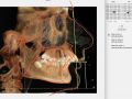 Skeletal CII Case - Radiographs