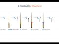 Endodontic Case 12 - ProTaper Ultimate - Premolar Final