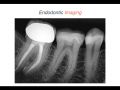 Endodontic Case 15 - Which Tooth Is It? - Diagnosis