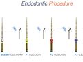 Endodontic Case 20 - #31 Retreatment - Procedure Continuation