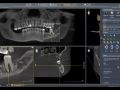 Evaluating a New Patient with CBCT