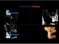 Endodontic Case 23 - 4 Canal Molar - Imaging