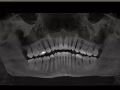 Would You See This Without CBCT