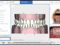 15 - October 2022 Update - SureSmile Fixing Teeth in Treatment Details