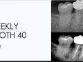 7. Weekly Tooth 40 - Diagnostics