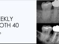 8. Weekly Tooth 40 - Oral Facial Pain