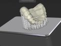 Reference Denture 9 - CAM Manufacturing