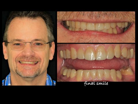 Orthodontics and CEREC ®
