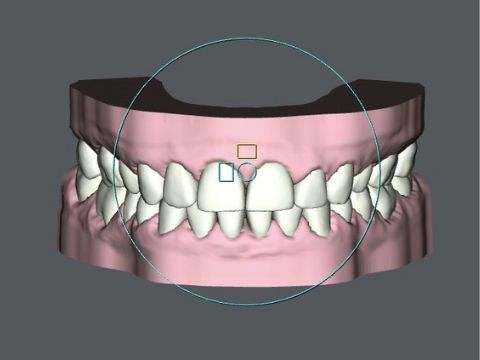The Updated SureSmile Software Provides Enhanced Workflow and Patient Experience